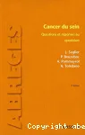 Cancer du sein